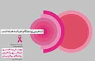 هفت عامل خطر قابل اصلاح در پیشگیری از ابتلا به سرطان پستان را بشناسیم